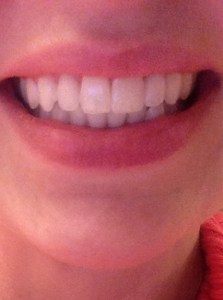 How weird that I am just now noticing my uneven lips when I smile? Here is the smile BEFORE...